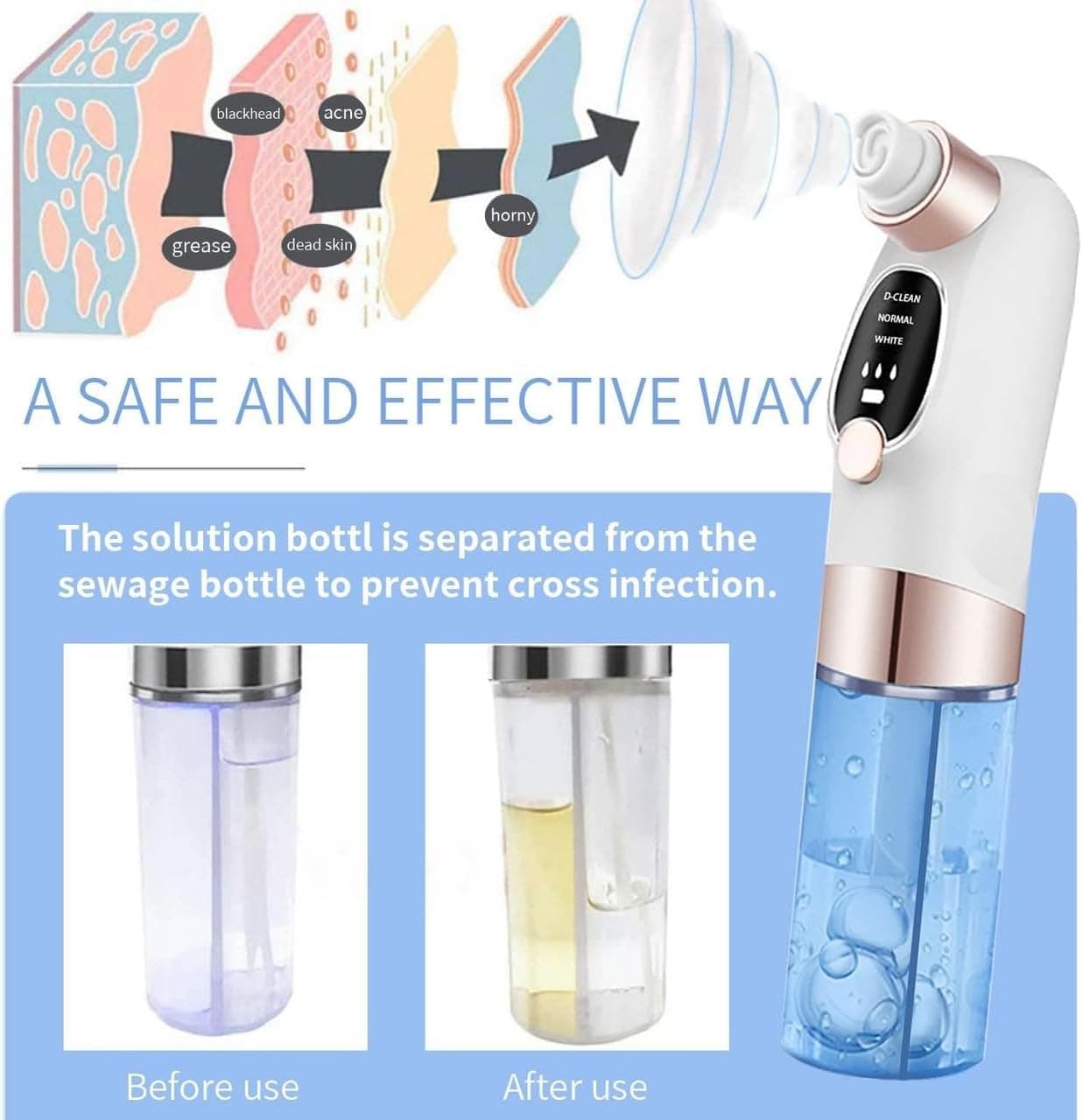 Electric Micro Bubble Blackhead Remover & Pore Vacuum Cleaner view 2