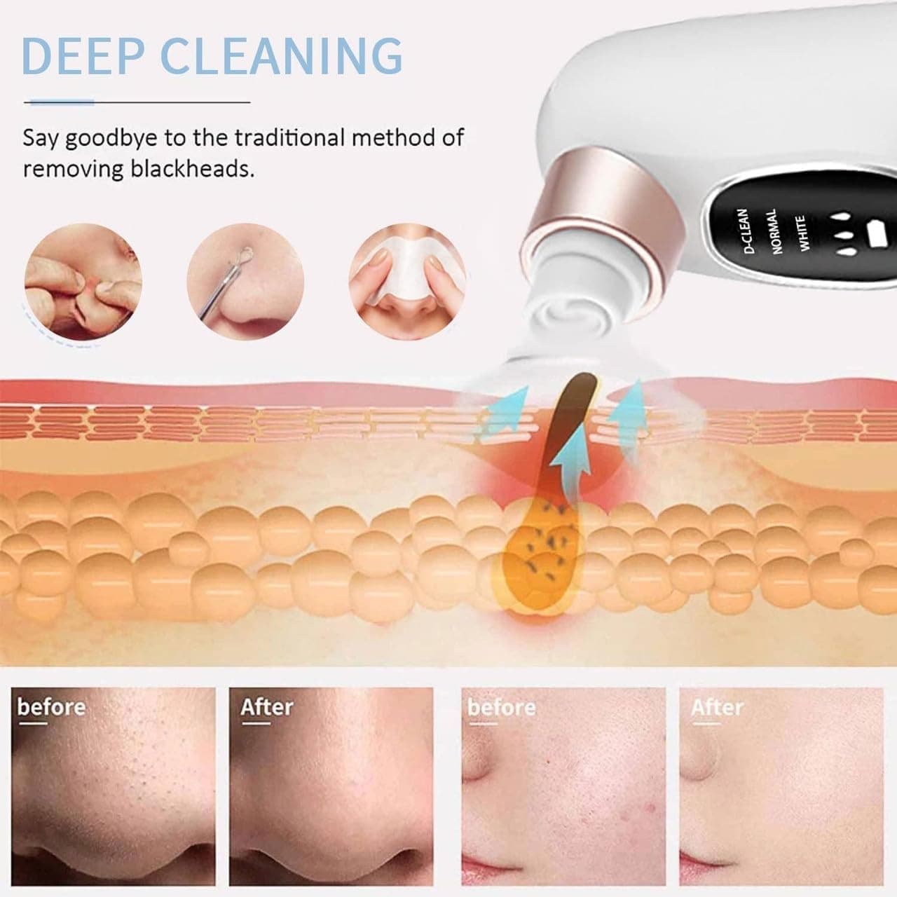 Electric Micro Bubble Blackhead Remover & Pore Vacuum Cleaner view 4