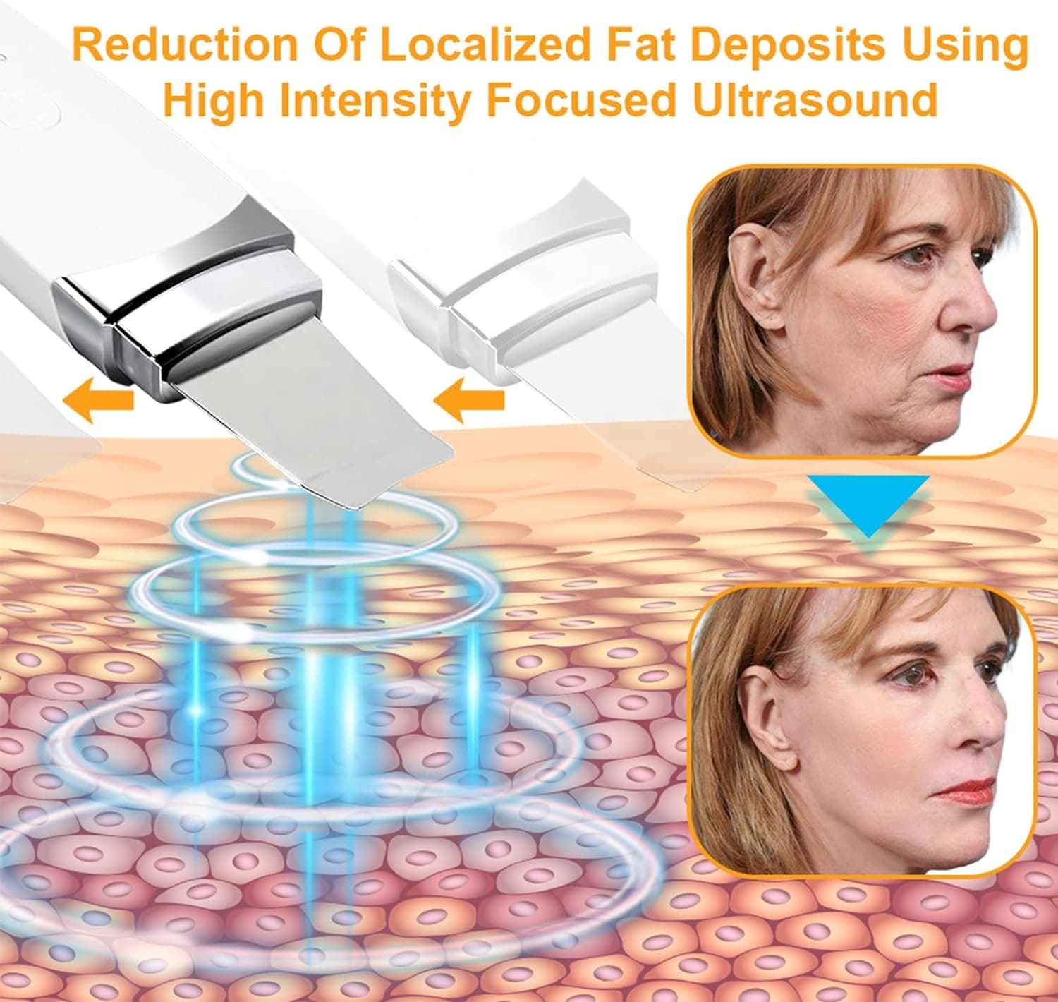 Ultrasonic Ion Cleaner Face Lifting And Firming Facial Massager view 3